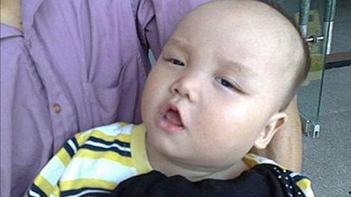 吃小瓜舌头疼,揭秘小瓜引发舌头疼的真相